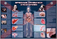 Электрифицированный стенд "Вредные привычки: алкоголизм" - fgospostavki.ru - Донецк