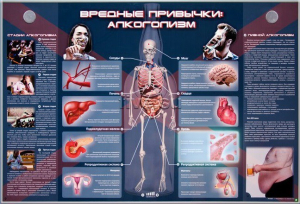 Электрифицированный стенд "Вредные привычки: алкоголизм" - fgospostavki.ru - Донецк